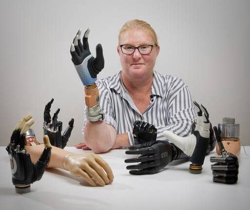 First-ever bionic hand actually merges with user’s nervous and skeletal systems