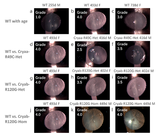 Slit lamp images of eyes from mice of different genotypes. Representative slit lamp images show the extent of lens opacity in WT lenses aged (a) 255 days, (b) 493 days, and (c) 738 days with apparent cataract gradings of 1.0, 4.0, and 3.0, respectively.