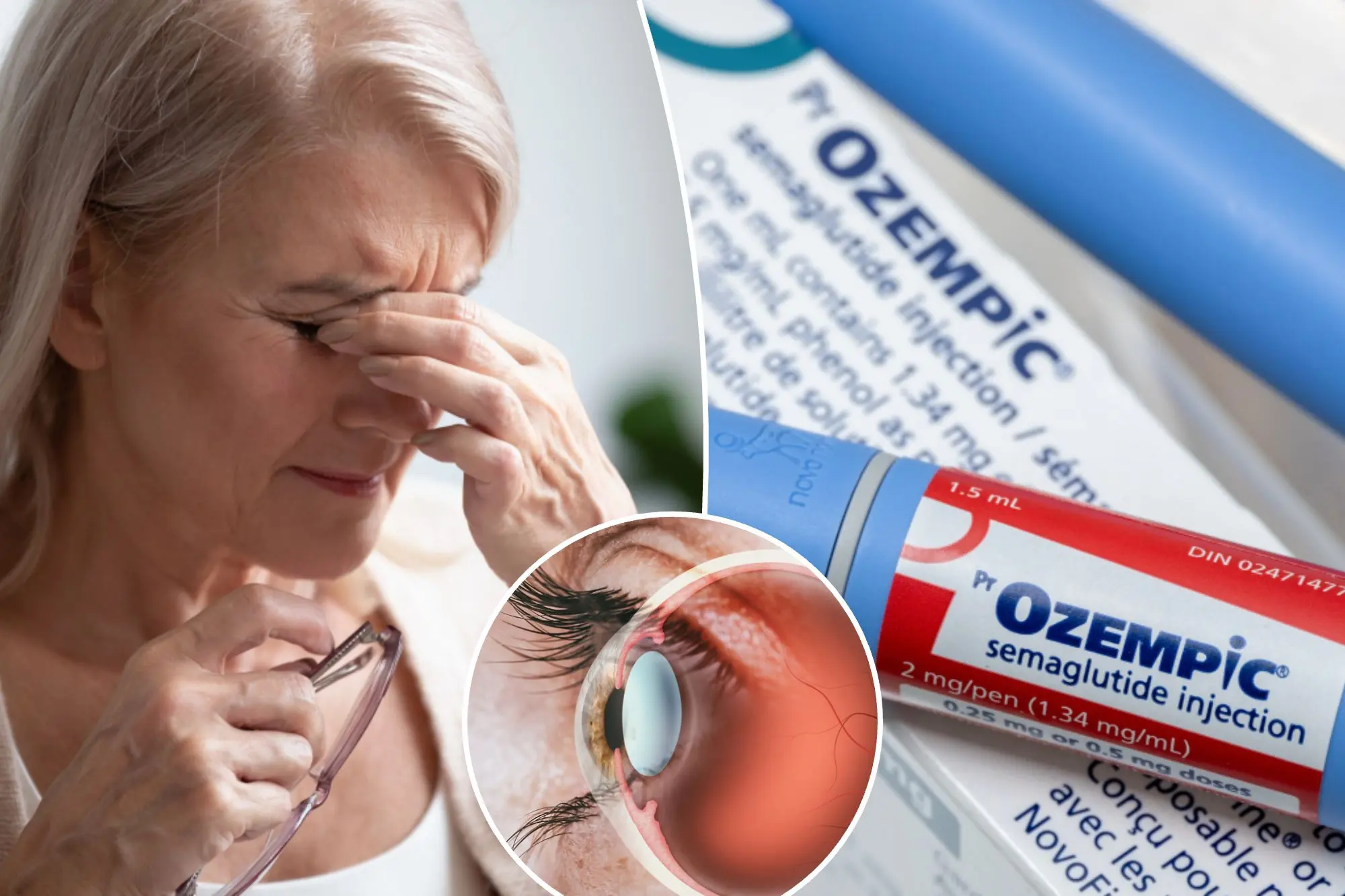 Study has found a troubling link between the use of semaglutide (marketed as Ozempic or Wegovy) and an increased risk of developing a potentially blinding eye condition