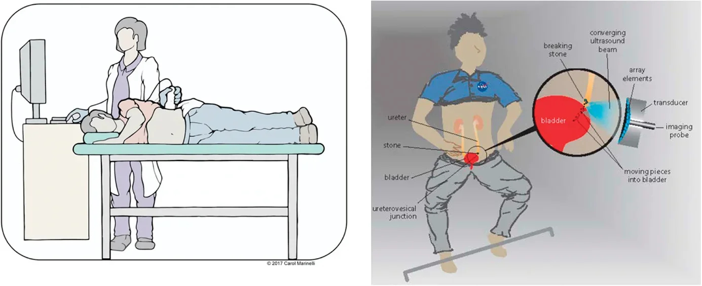 Procedure diagrams of use in the ED or clinic as performed in this study (left) and as envisioned by our National Aeronautics and Space Administration sponsors for use in space travel (right). 