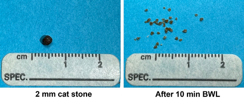 Kidney stone before and afetr 10 min BWL burst.