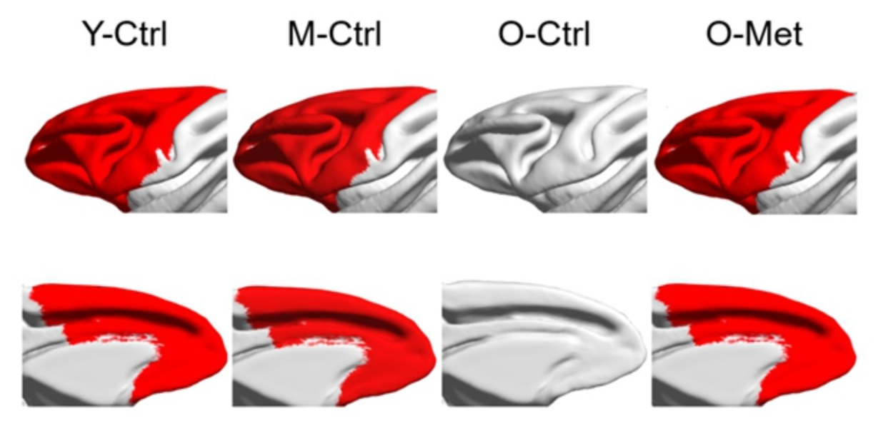 Metformin slows brain aging in primates.