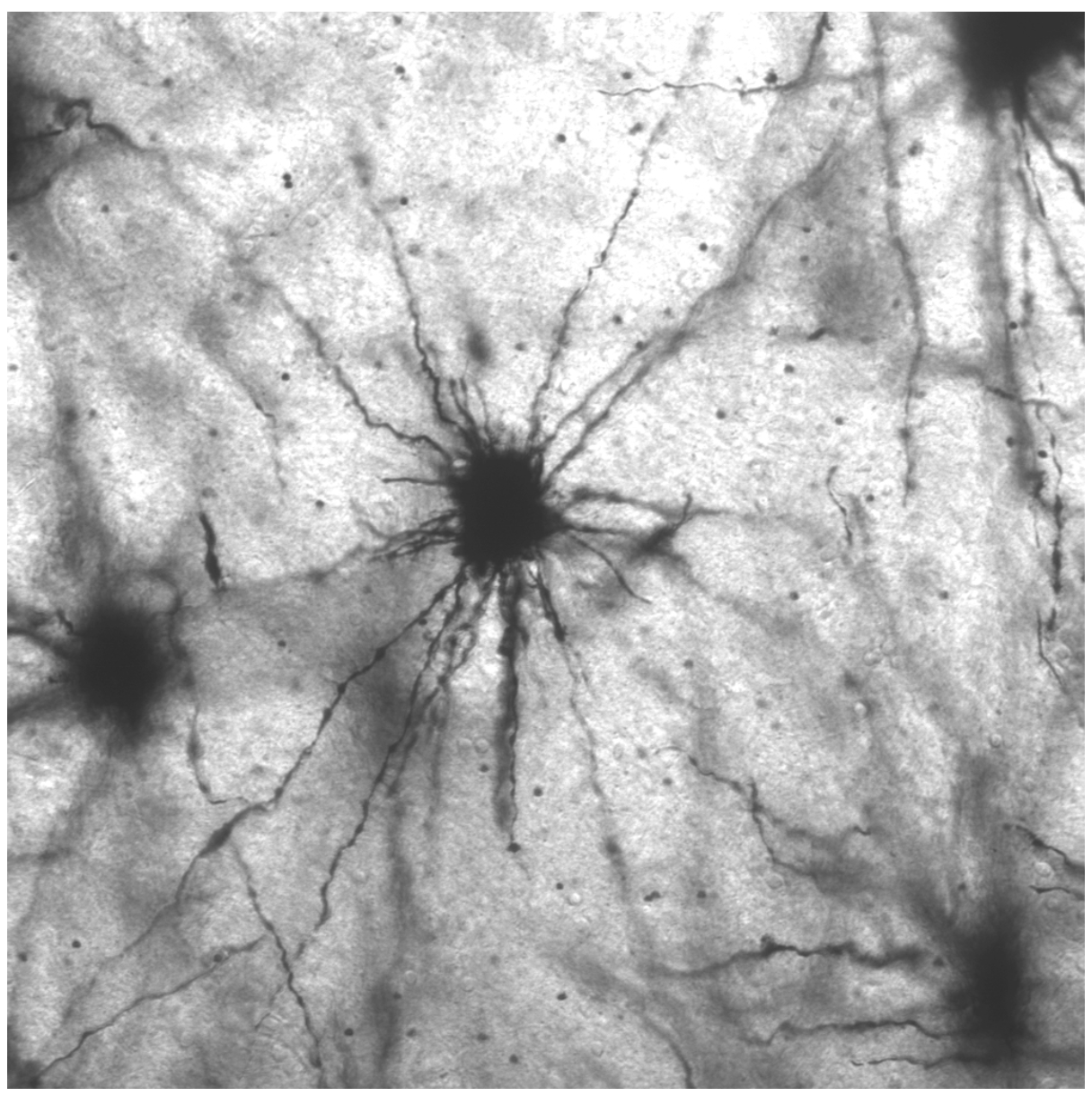 Metformin slows brain aging in primates.