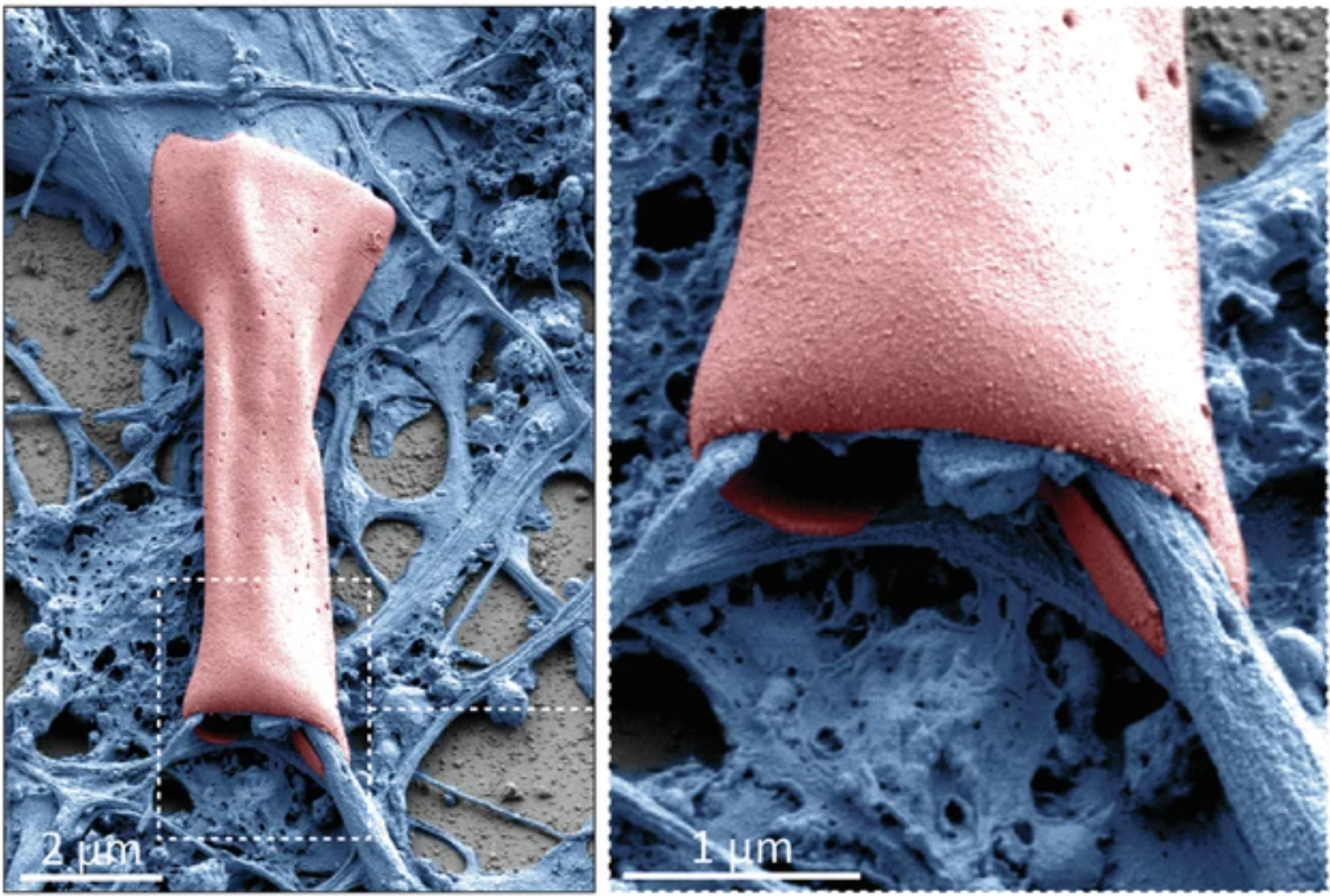 MIT researchers have developed tiny, wireless devices that wrap around neurons.