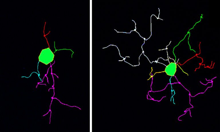 Metformin treatment changed microglia from a proinflammatory phenotype (left) into a noninflammatory phenotype (right) in the aged hippocampus.