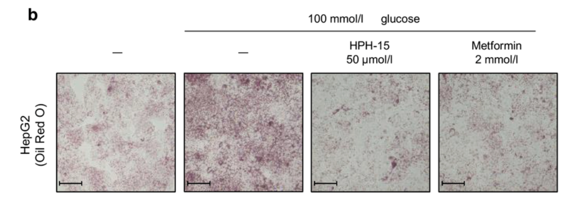 Lipid level assessment by Oil Red O staining of HepG2 cells treated with HPH-15 or metformin for 16 h followed by exposure to 100 mmol/l d-(+)-glucose for 1 day; the cells were observed using a microscope.