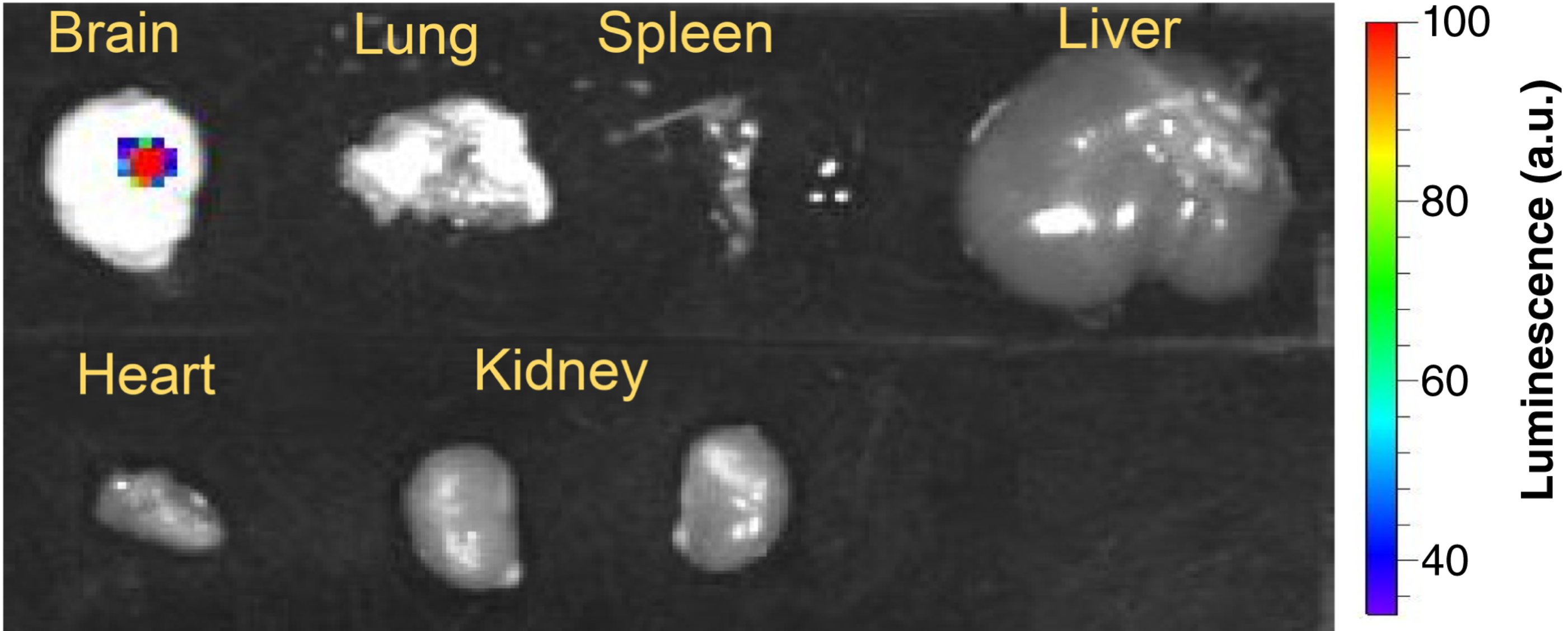 Ex vivo IVIS imaging confirmed mLumiOpto expression in GBM xenografts but not in normal organs.