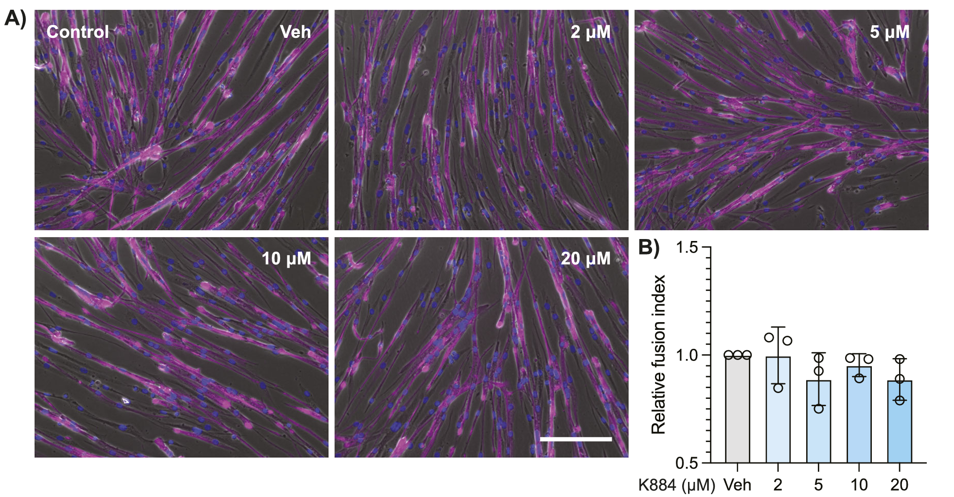 PTPN1/2 inhibition with K884 enhances myogenic differentiation of Duchenne muscular dystrophy (DMD) muscle stem cells (MuSCs).