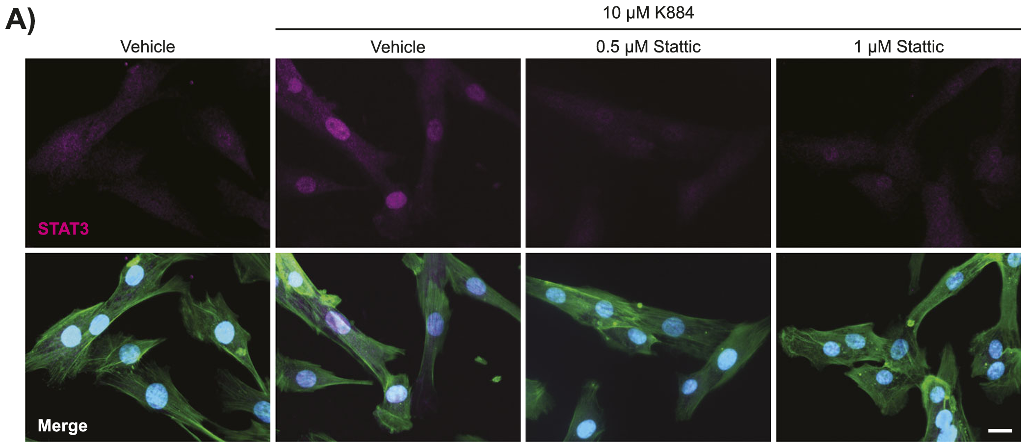 Inhibition of STAT3 activity prevents myogenic differentiation and is not rescued by K884 in Duchenne muscular dystrophy (DMD) muscle stem cells (MuSCs).