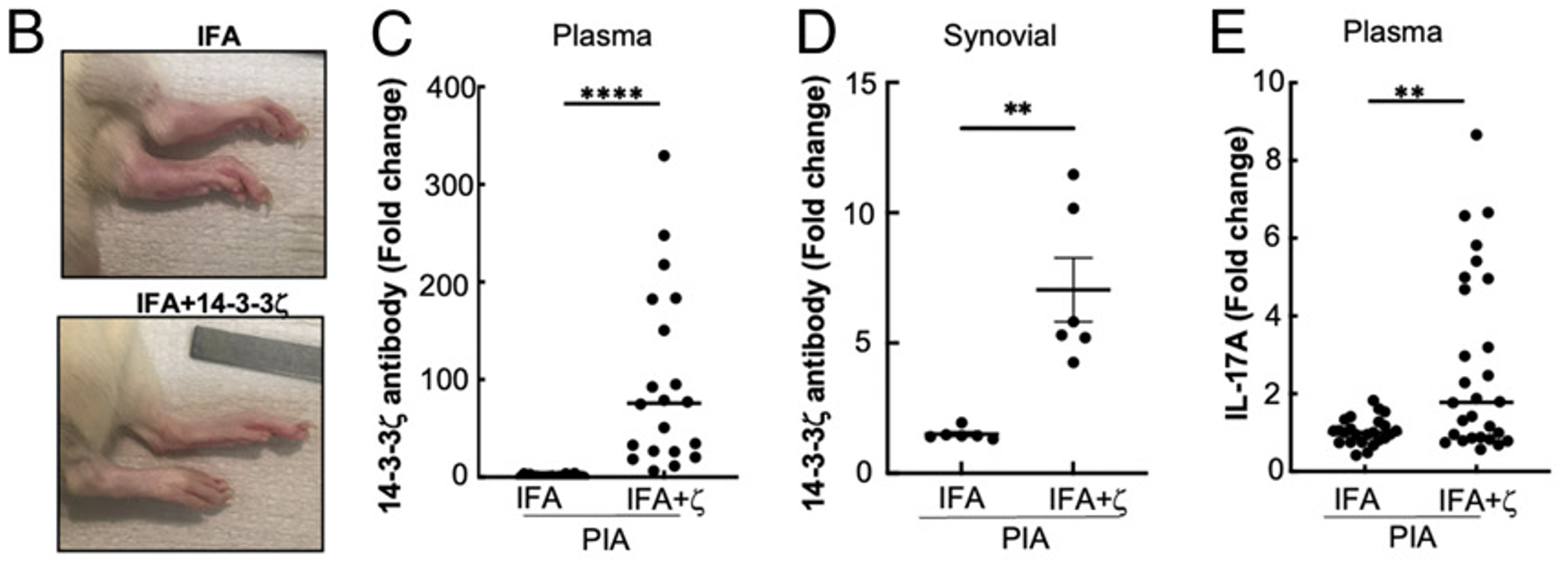 Representative pictures of inflamed joints are shown. (C and D) The 14-3-3ζ antibody level in the plasma (C) and synovial fluid (D) was measured using standardized ELISA. (E) The plasma IL-17A level in the IFA-treated versus IFA+14-3-3ζ–treated animals was measured using ELISA. 