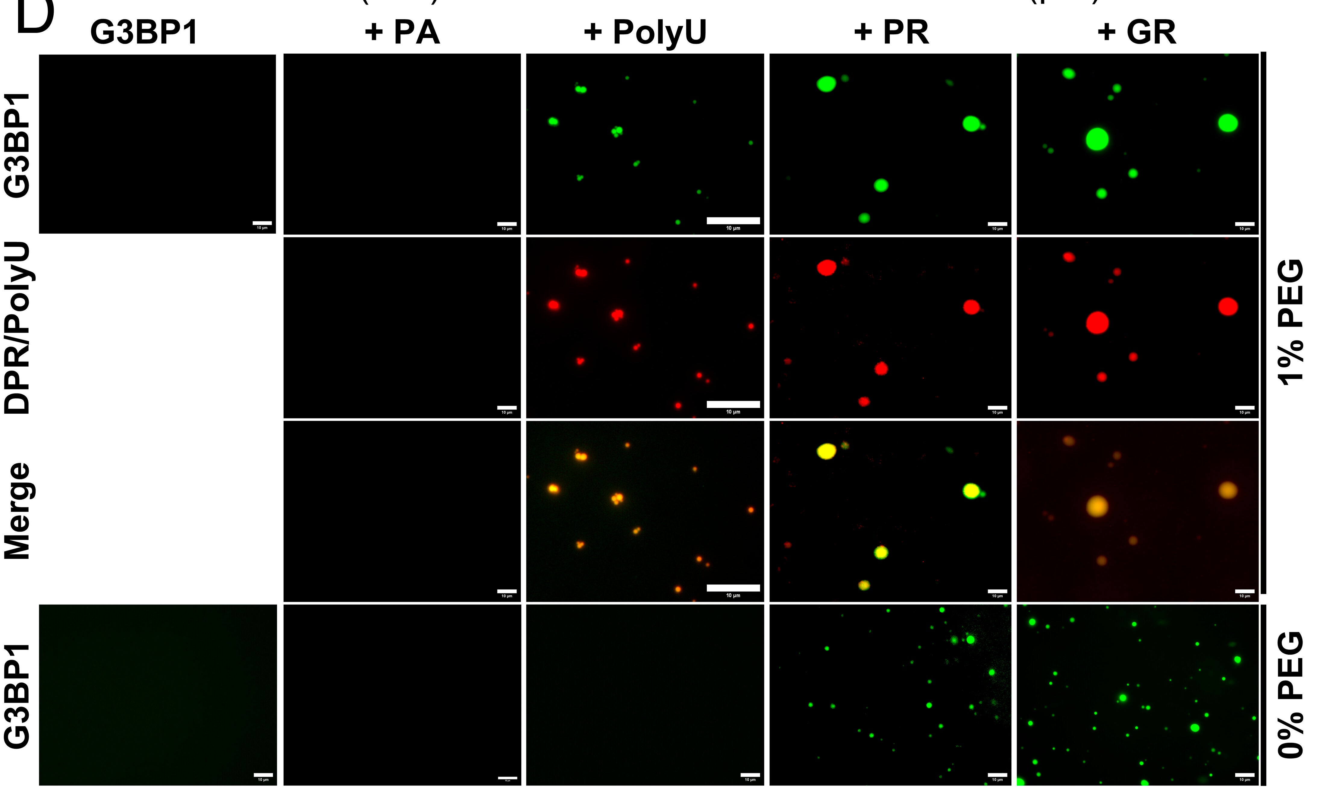 Microscopic images of LLPS of G3BP1 in the presence (Upper panels) or absence (Lower panels) of 1% PEG. To Alexa-488-labeled G3BP1 (60 µM), nothing, PA30 (50 µM), polyU (40 ng/µL), PR30 (50 µM) or GR30 (50 µM) was added (all partners labeled with RED-NHS or Cy5 for PolyU, typically 1% of total protein/RNA is labeled). (Scale bar, 10 µm.)