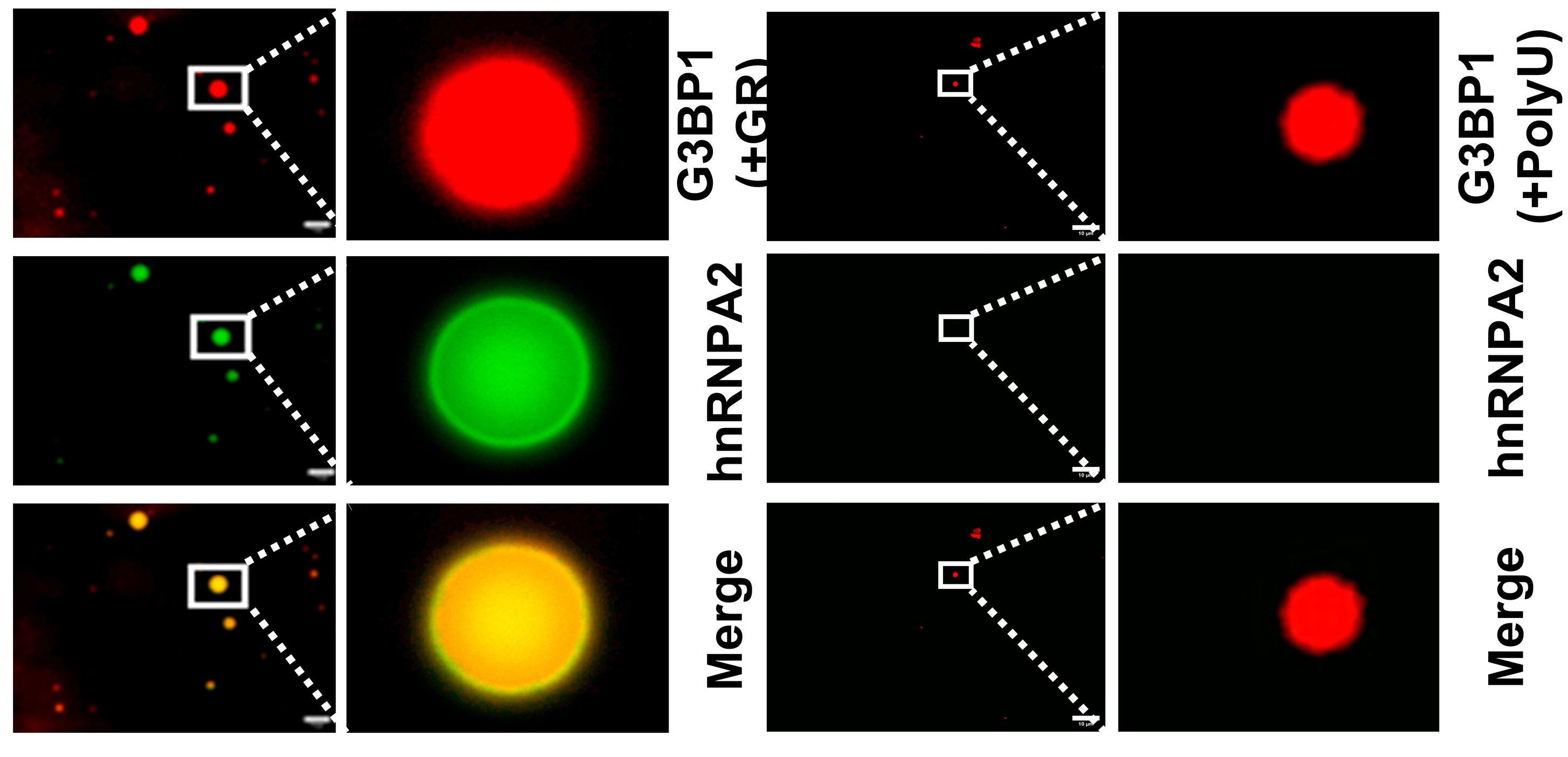 Microscopic images of RED-labeled G3BP1 (30 µM) with nonlabeled GR30 (30 µM, Left) or polyU (40 ng/µL, Right), in the presence of Alexa-488-labeled hnRNPA2.