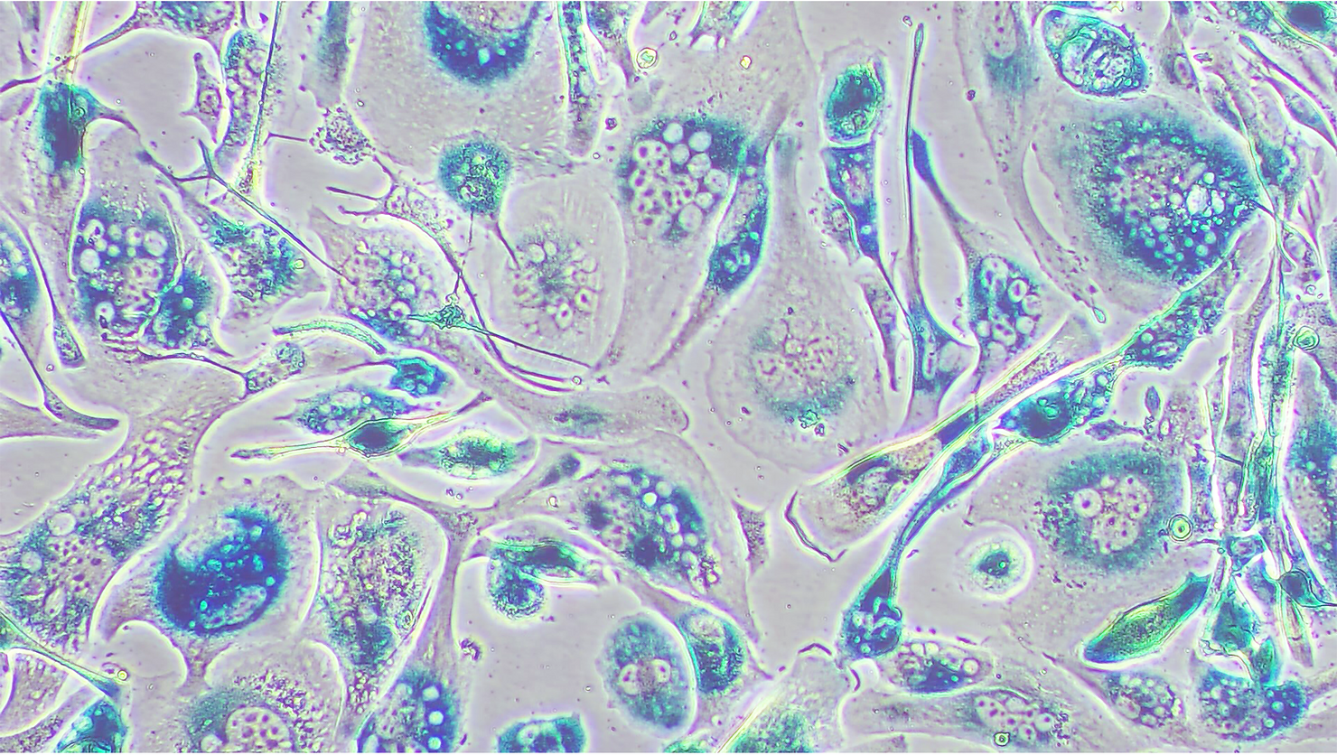 Senescent tumor cells, mouse pancreatic cancer cell culture. 