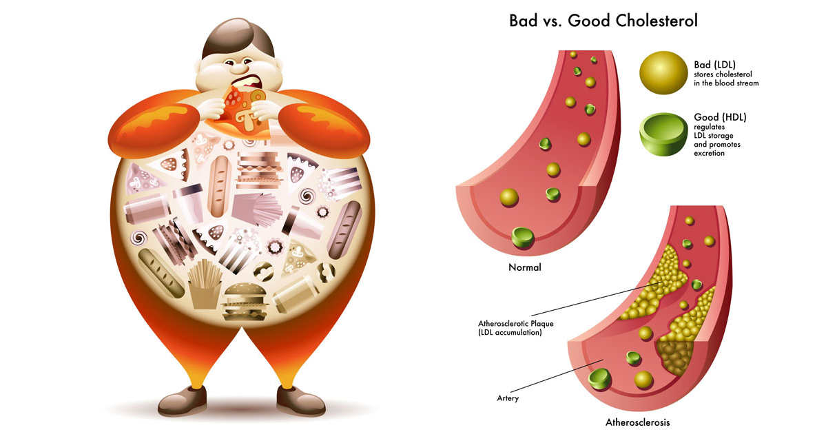 Good vs bad cholesterol.