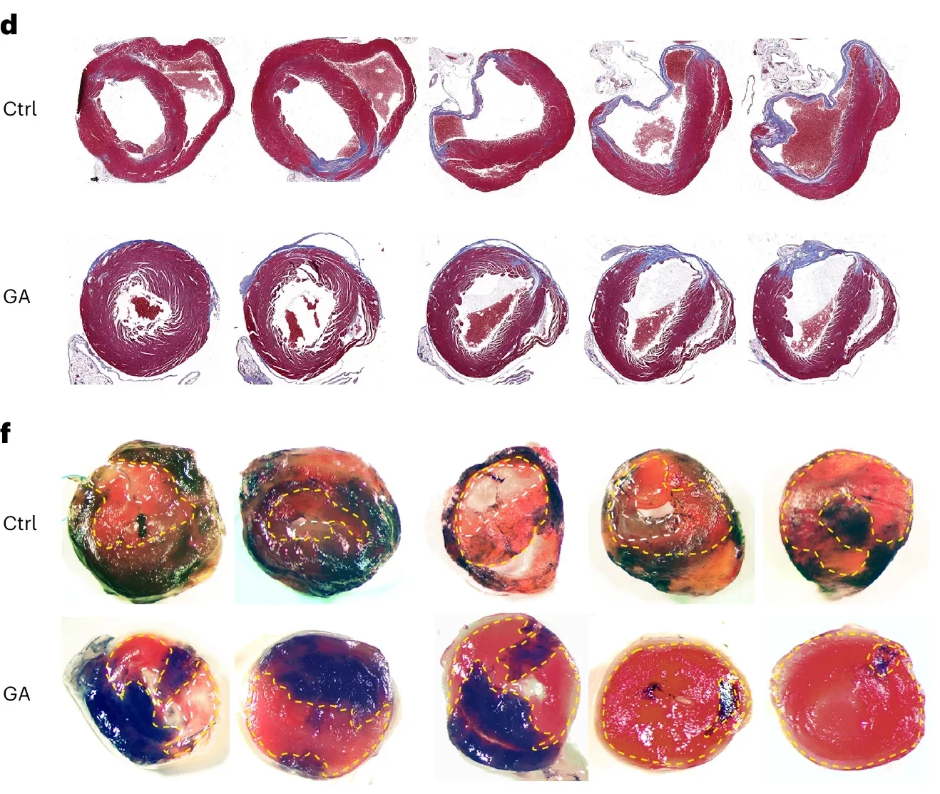 GA improves mouse cardiac function after MI.