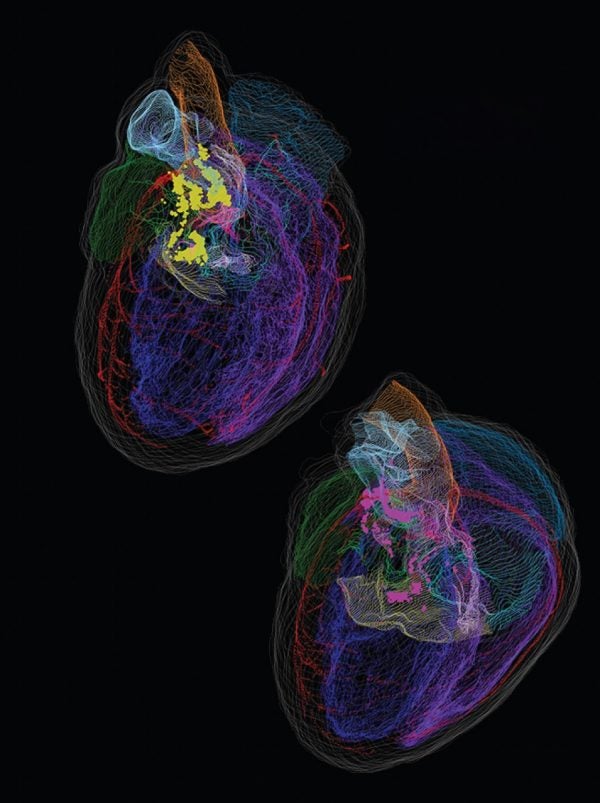 Male vs. Female: A comparison of the “little brain” in the male heart (yellow dots) and female heart (pink dots). The distribution of the neurons is different, and there are fewer neurons in the female heart.