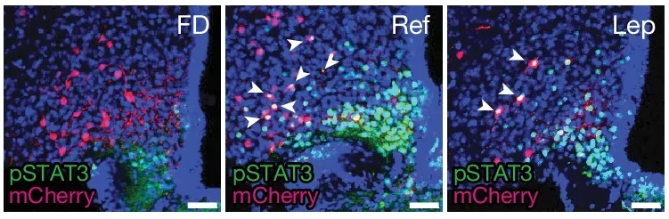 Activation of BNC2 neurons by feeding. 