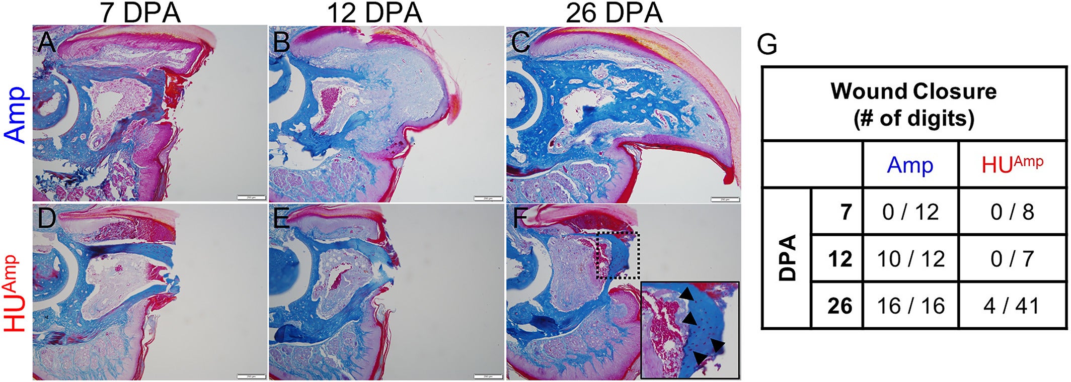 Hindlimb unloading inhibits wound healing. (A–F) Representative images of Mallory's trichrome staining of Amp (A–C) and HUAmp (D–F) digits at 7, 12, and 26 days post amputation (DPA) (scale bar = 100 μm). (F) Inset showing necrotic osteocytes (arrowheads). (G) Quantification of wound closure in Amp and HUAmp digits at different stages of regeneration.