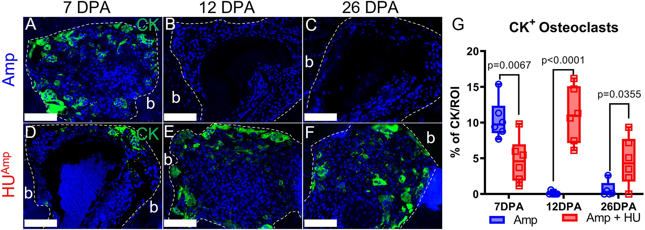 Hindlimb unloading delays osteoclast resorption. (A–F) Representative images of cathepsin K (CK)-immunopositive multinucleated osteoclasts in Amp (A–C) and HUAmp (D–F) digits at 7, 12, and 26 days post amputation (DPA) (scale bar = 100 μm). (G) Quantification of CK-immunopositive osteoclasts in Amp and HUAmp digits at different stages of regeneration (unpaired t test, n = 5–6 digits/group).