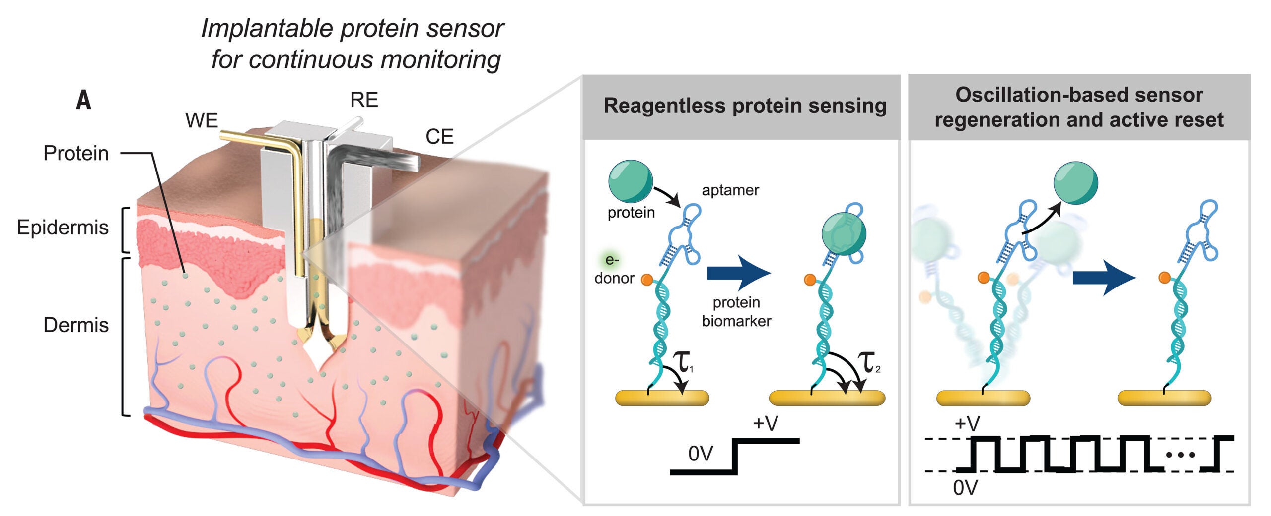 Schematic of microdevice inserted into skin. The device delivers ISF to the working electrode (WE), reference electrode (RE), and counter electrode (CE) upon insertion into the skin.