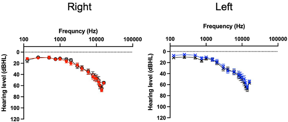 Audiogram for per protocol participants. USL group (color, n = 31) WN group (black, n = 30). Mean thresholds and standard error bars are shown.