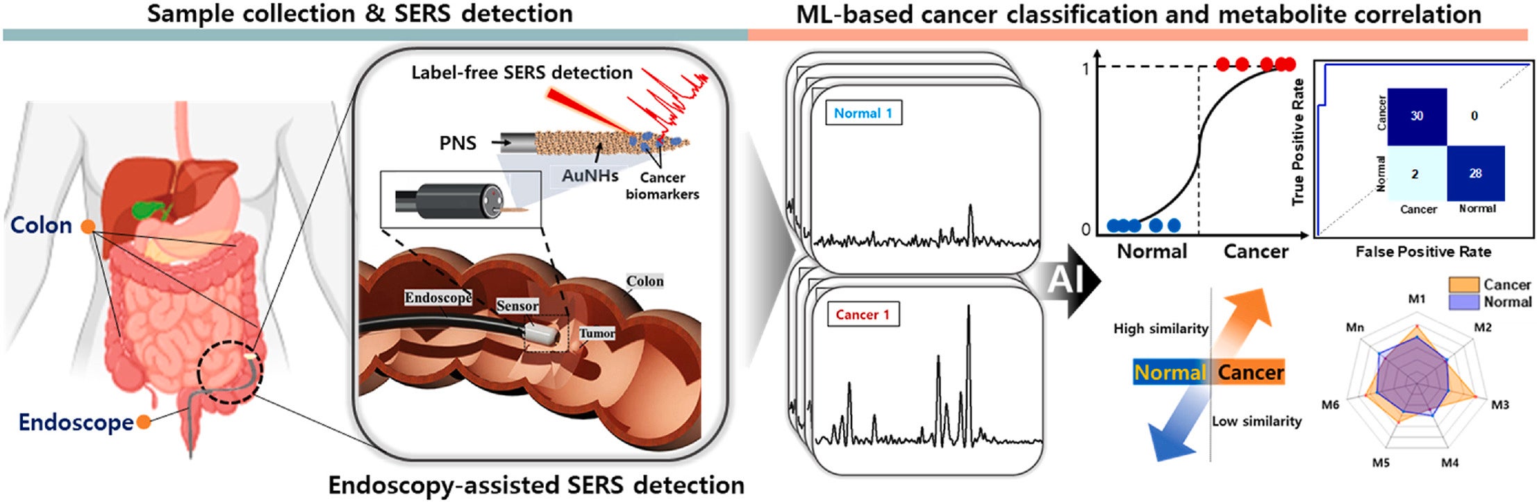 Schematic illustration of the endoscopic-assisted PNS sensor for intestinal mucus sampling and colorectal cancer diagnosis.