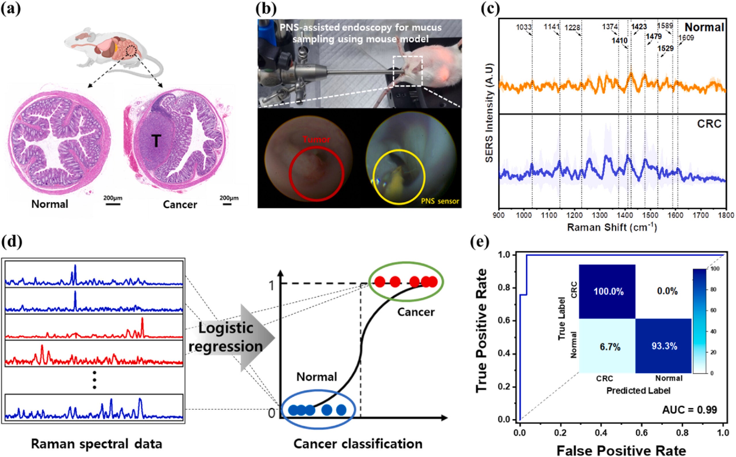 Colorectal cancer sensing and diagnosis. H&E staining analysis of normal and cancerous colons from mouse models, T indicates the tumor cells growing in the submucosal area