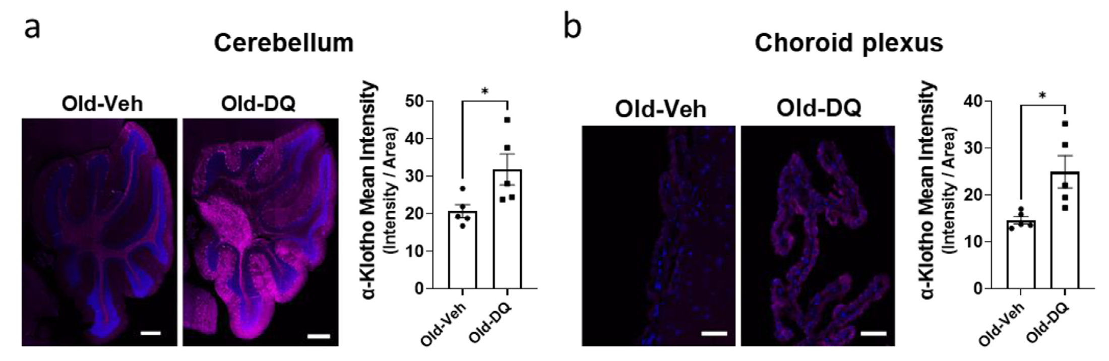 Senolytics increase brain a-Klotho in old mice. Naturally-aged mice (female, 28-month-old) were treated with vehicle (n = 5) or D+Q (n = 5). Brain a-Klotho was analysed by IF. 