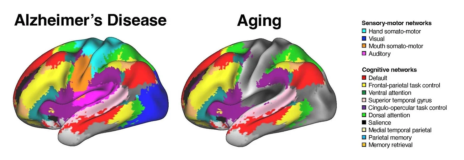 Alzheimer’s disease and aging are associated with distinct patterns of brain network disruption. Alzheimer’s impacts brain connectivity, including both higher order cognitive networks and sensory and motor networks (left), while aging is limited to disruption of cognitive networks