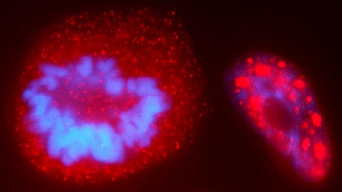 Researchers have developed a tool that can bend DNA strands using light. The work represents a new way to probe the genome. Shown here, from an unrelated study, are chromosomes (blue) inside a human cell nucleus.

