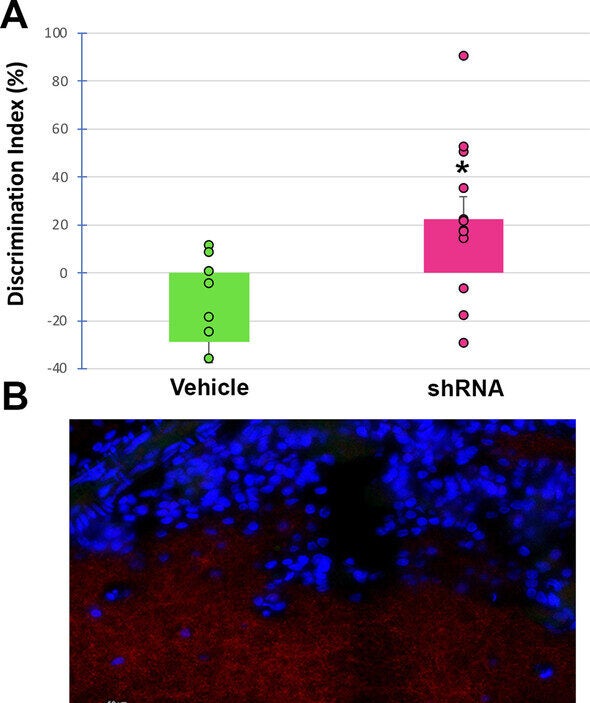 Intranasal adeno-associated virus delivery of AAV9-MeCP2-GFP-mouse HTR2A-shRNA improves memory in rats. The target sequence used to synthesize the shRNA is 100% conserved between mice and rats. 