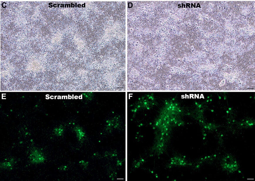 Transduction efficiency of AAV9-mHTR2A-shRNA in mouse primary cortical neurons.